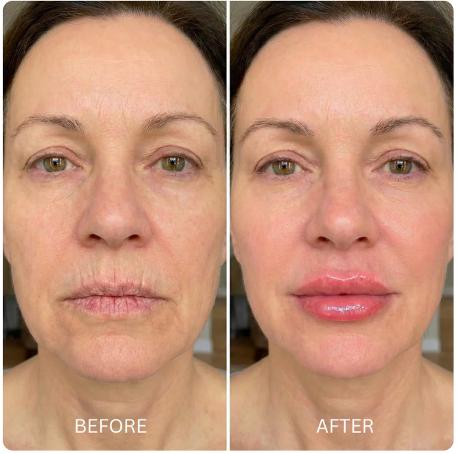 Aura Glow Adaptive Balm