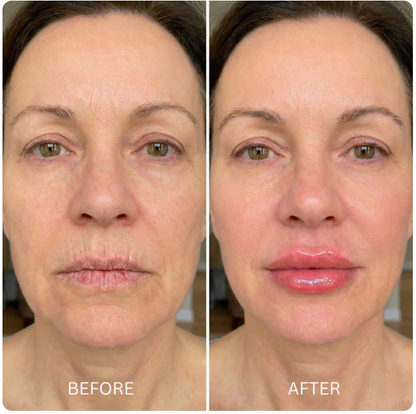 Aura Glow Adaptive Balm